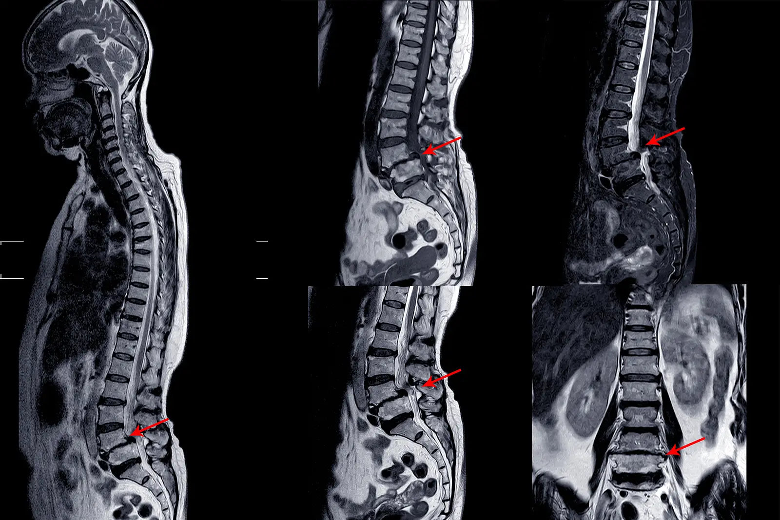 low_back_anatomy_3.webp__PID:5fa14bf8-fa20-4464-a2fb-9fe892c9820c